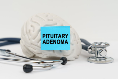 Adenom hipofizar