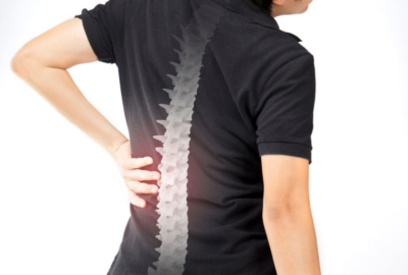 Cand este cazul sa operam hernia de disc?