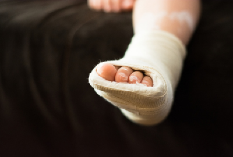 Ce sa faci pentru o recuperare completa dupa fractura de calcaneu