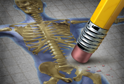Coxartroza: simptome, cauze, tratament si preventie