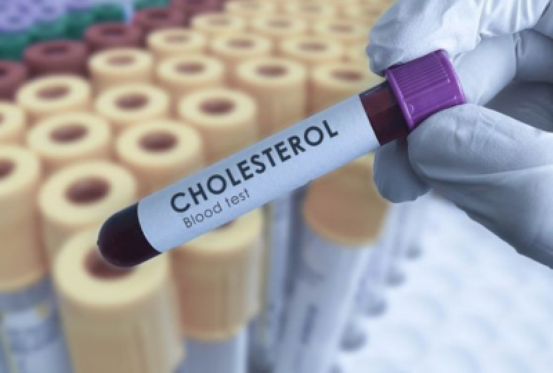 Colesterol HDL