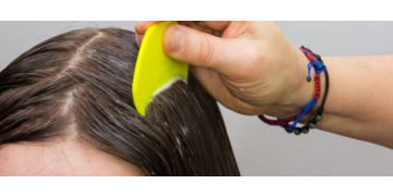 Cum recunosti pediculoza la copii si adulti si ce sa faci imediat