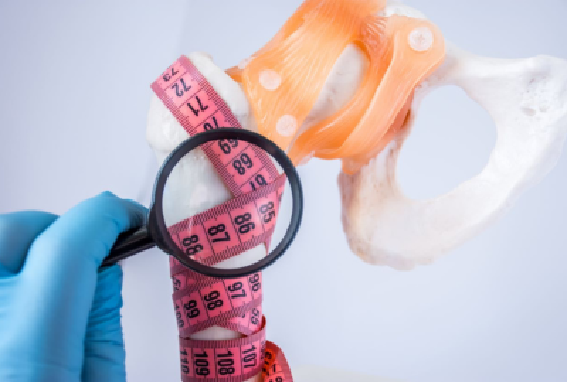 Semne si simptome ce anunta diagnosticul de osteoporoza