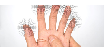 Furnicaturile in maini – posibile cauze