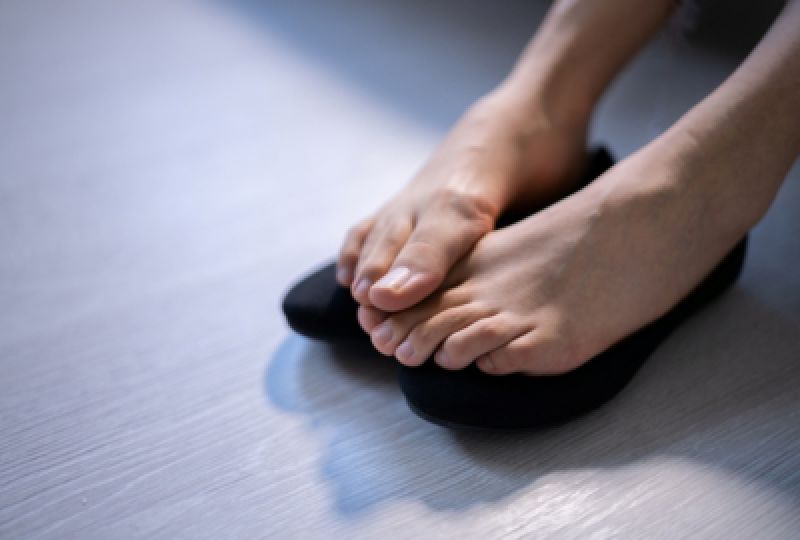 Picioare care transpira excesiv/abundent: cauze, tratamente