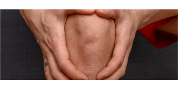 Ligamente incrucisate