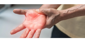 Neuropatie periferica: tablou clinic, diagnostic si tratament