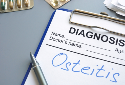 Osteita
