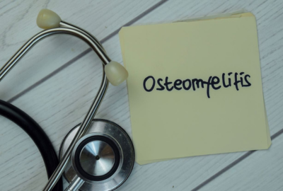 Osteomielita: cauze, simptome, diagnostic si tratament