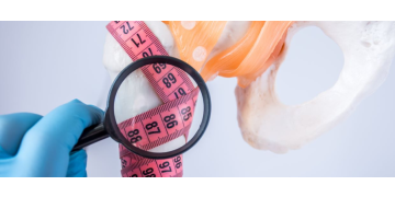 Semne si simptome ce anunta diagnosticul de osteoporoza