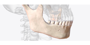 Sfaturi importante privind recuperarea dupa fractura de mandibula