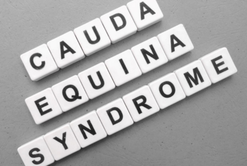 Sindromul coada de cal: ce este, care sunt simptomele asociate si optiuni de tratament