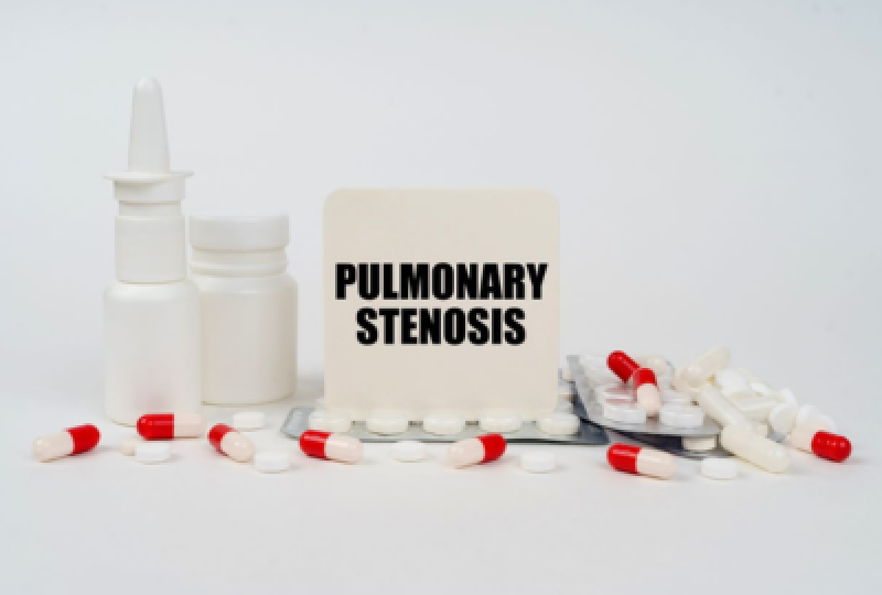 Stenoza pulmonara – simptome, cauze, tratament