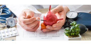 Incontinenta urinara