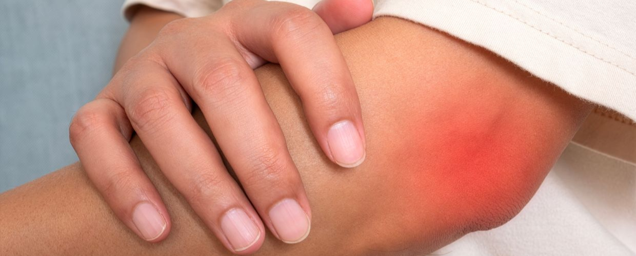 Cum se trateaza o galma sau o umflatura aparuta dupa o lovitura puternica