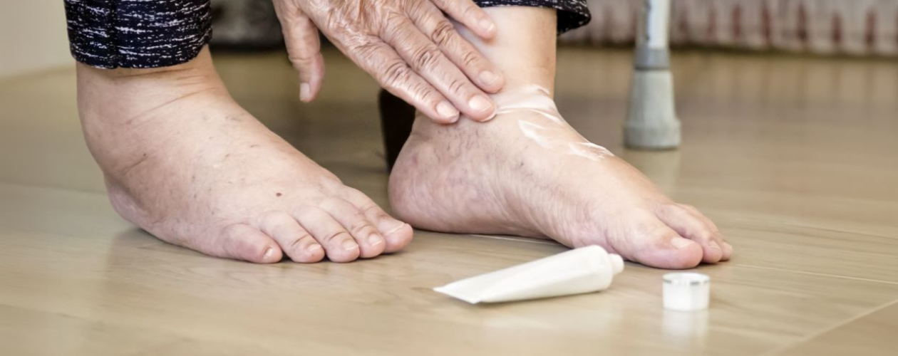 Ingrijirea piciorului diabetic: Produse esentiale pentru tratament si preventie