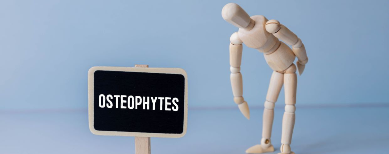 Osteofite - cauze, tipuri in functie de localizare si tratament