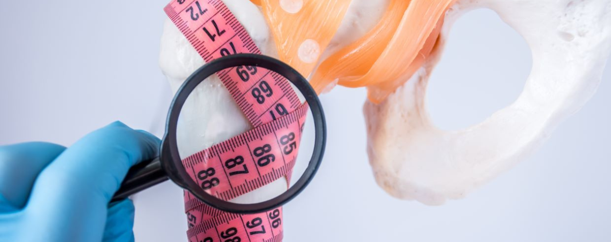 Semne si simptome ce anunta diagnosticul de osteoporoza