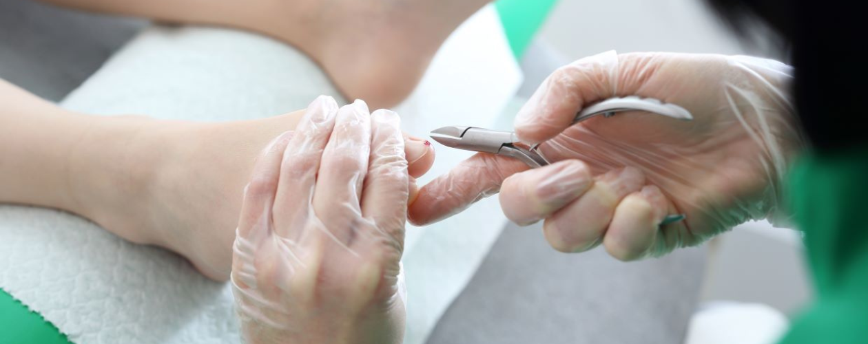 Unghie incarnata - simptome si tratament